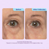 🔥 Instant Lift Eye Gel for Puffiness, Bags & Dark Circles