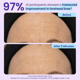 🔥 Instant Lift Eye Gel for Puffiness, Bags & Dark Circles